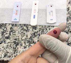 Ação gratuita oferece testes rápidos de ISTs neste sábado (25), em Americana