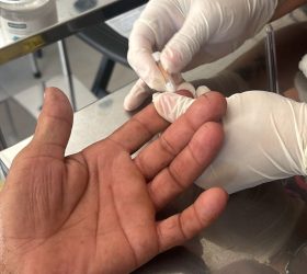 Julho Amarelo: Saúde de Americana reforça importância da testagem e vacinação contra hepatites