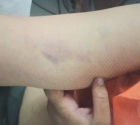 Foto: Divulgação/GAMA