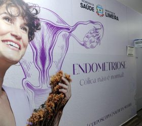 Foto: Divulgação/Prefeitura de Limeira